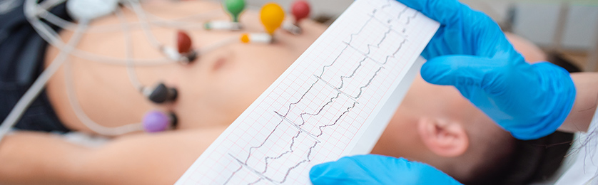 Cardiovascular